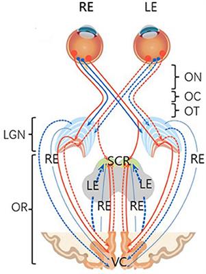 Cognitive dysfunctions in high myopia: An overview of potential neural morpho-functional mechanisms